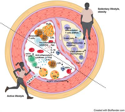Immunological mechanisms of exercise therapy in dyslipidemia